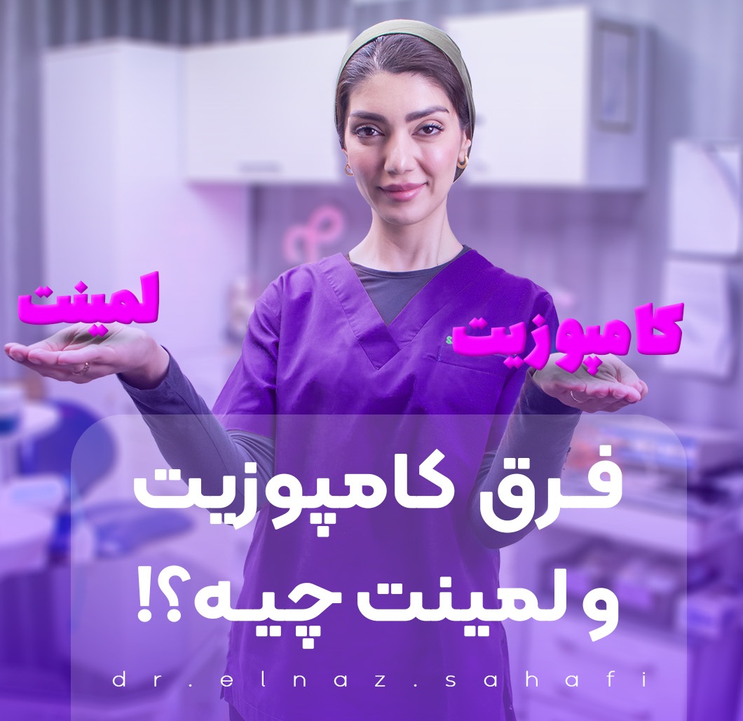 فرق ونیر کامپوزیت و لمینت چیه؟