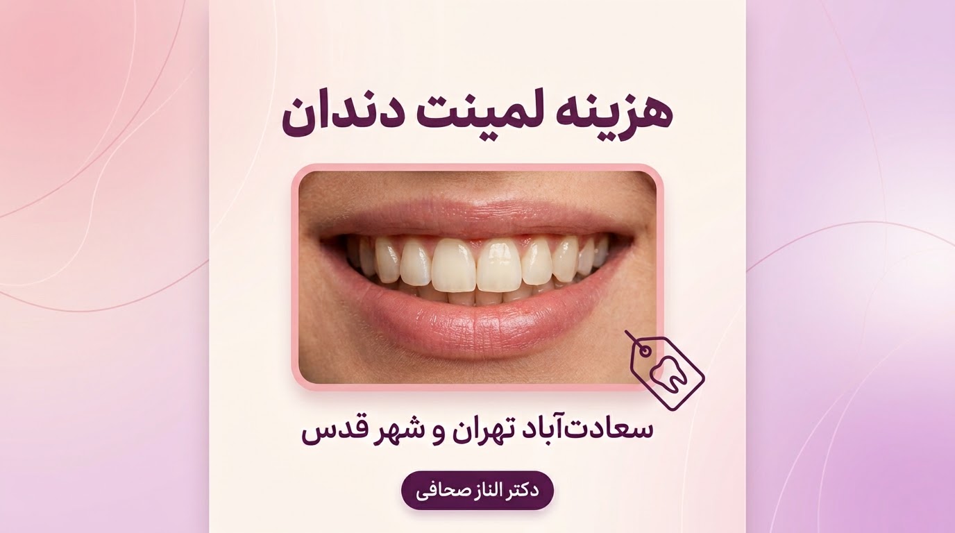 هزینه لمینت دندان در سعادت‌آباد تهران و شهر قدس به چه عواملی بستگی دارد؟